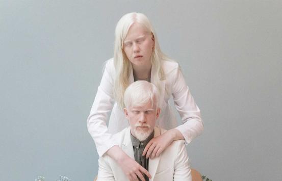 frente a un fondo gris aparecen dos personas albinas, los dos visten de color blanco, al frente está uno sentado, atrás de pie hay una mujer abrazándolo